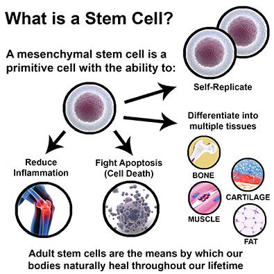 What is stem cell therapy